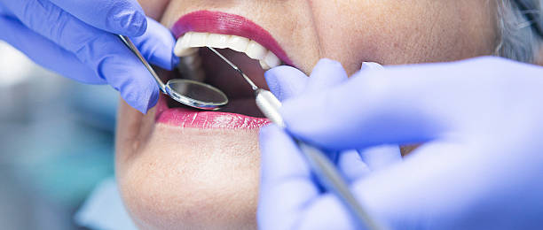 Best Emergency Treatment for Dental Infections or Abscesses in Culver, IN